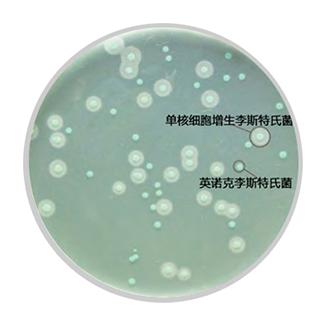 单核�l�胞(y��u)增生李斯�Ҏ(gu��)��菌培�ȝ���? /><span style=